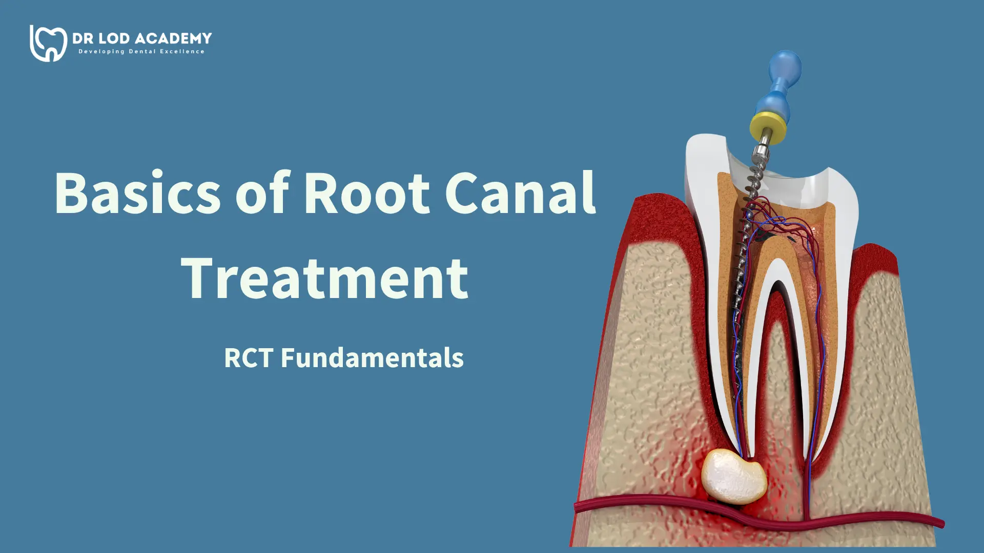 Basics of Root Canal Treatment Course